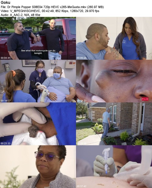 298145544_dr-pimple-popper-s08e04-720p-hevc-x265-megusta.jpg