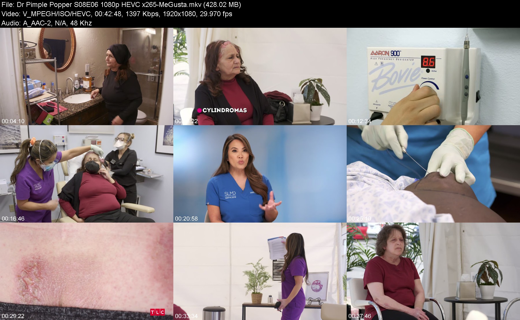 300791170_dr-pimple-popper-s08e06-1080p-hevc-x265-megusta.jpg