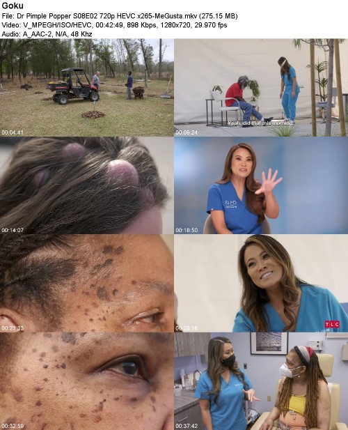 295547736_dr-pimple-popper-s08e02-720p-hevc-x265-megusta.jpg